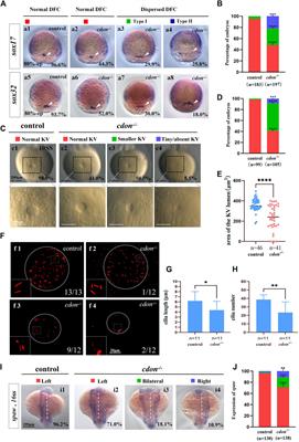 Cdon is essential for organ left-right patterning by regulating dorsal forerunner cells clustering and Kupffer’s vesicle morphogenesis